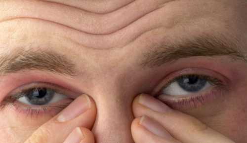 При синдроме сухого глаза используют препараты, имитирующие естественную слезу