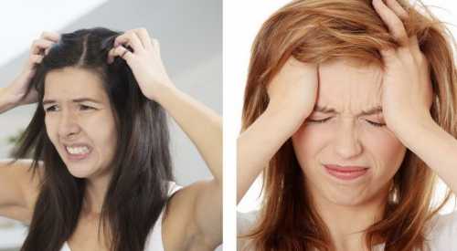 Не стоит красить волосы, если на голове отмечается сыпь, если кожа головы шелушится или возникает раздражение