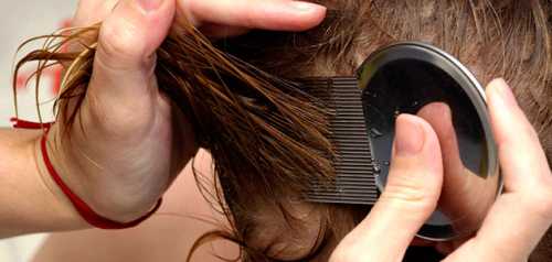 Обработка волос и кожи головы керосином может вызвать сильное раздражение