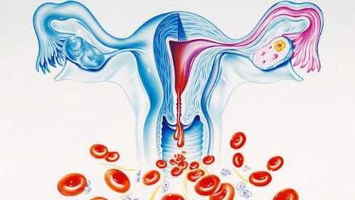 Часто узи матки имеет решающее значение для диагностики причин маточного кровотечения